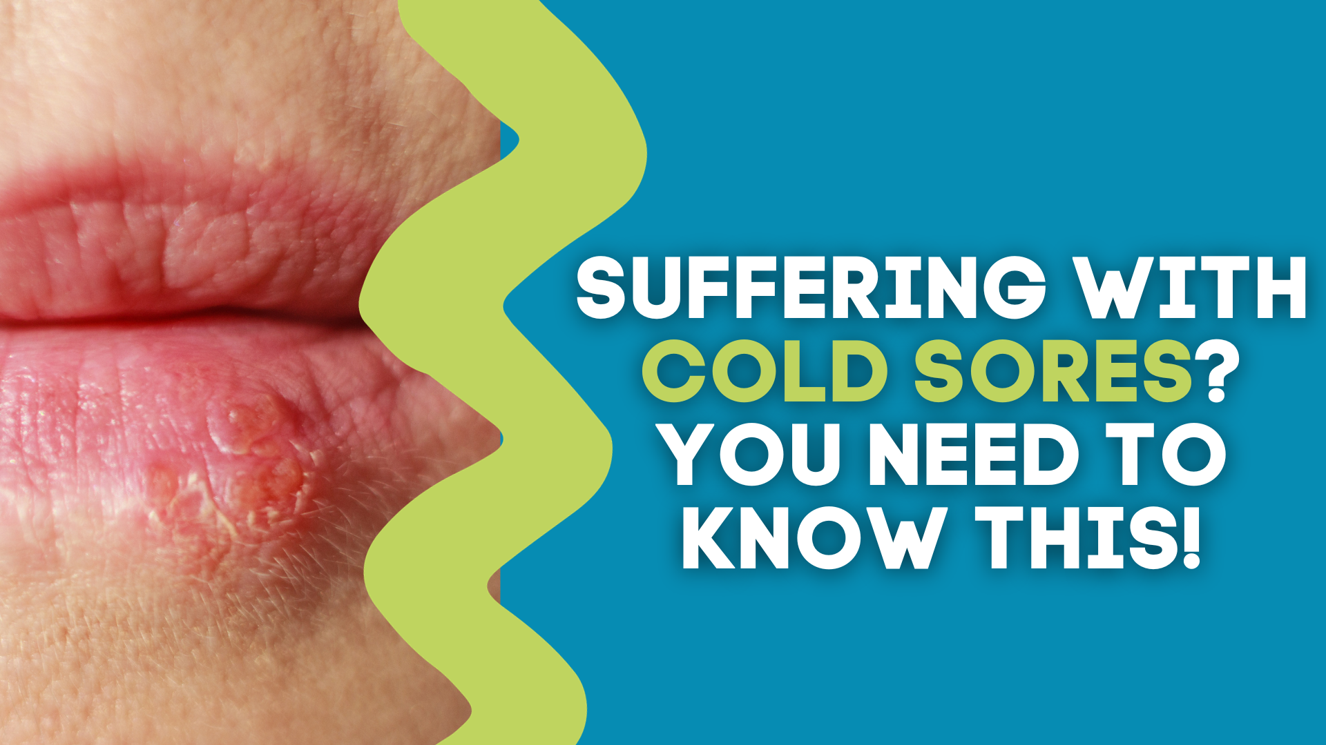 SUFFERING WITH COLD SORES? YOU NEED TO KNOW THIS! The Gut Health Hub