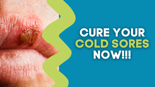 CURE YOUR COLD SORES NOW!