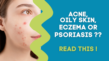 ACNE, OILY SKIN, ECZEMA OR PSORIASIS? READ THIS!