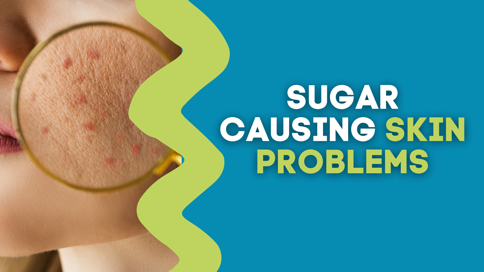 SUGAR CAUSING SKIN PROBLEMS – The Gut Health Hub