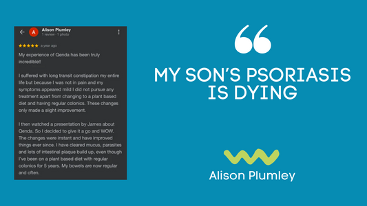 MY SON'S PSORIASIS IS DYING
