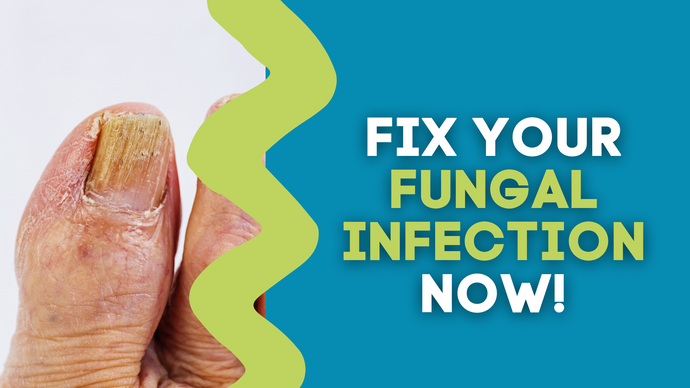 FIX YOUR FUNGAL INFECTION NOW!