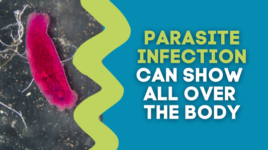 PARASITE INFECTION CAN SHOW ALL OVER THE BODY